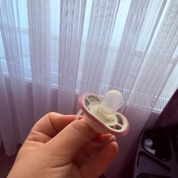 Emzikte Su Ve Köpük Birikmesi Bebeğin Sağlığını Tehdit Ediyor