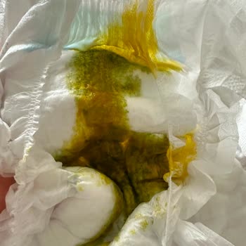 Molfix Premium Bebek Bezinde Kaka Renk Değişikliği Ve Şirketin Sessizliği
