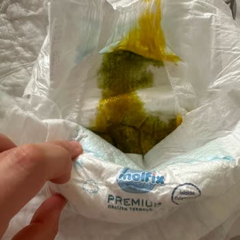 Molfix Premium Bebek Bezinde Kaka Renk Değişikliği Ve Şirketin Sessizliği