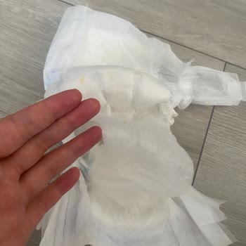 Molfix Bebek Bezi İç Katmanının Ayrılması Ve Artan Pişik Sorunu