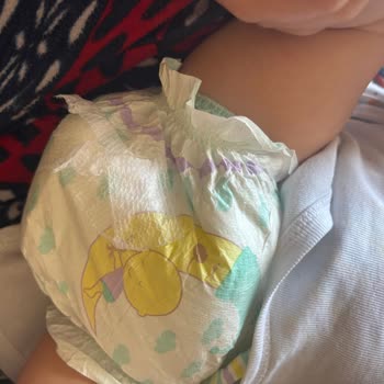 Jenny&Willy Markalı Bebek Bezinde Çiş Kaçırma Ve Baskı Hatası