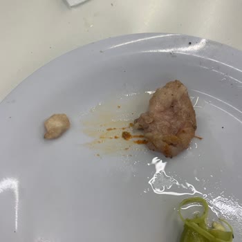Dönerde Çiğ Yağ Ve Kemik Parçası, Garsonun Umursamaz Tutumu