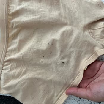 Keten Pantolonun İç Çamaşırına Bıraktığı Lint Ve Lekeler Hakkında Şikayet