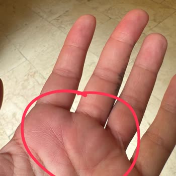 Fitamine Atakent Şubesinde EMS Seansı Sonrası Alerjik Reaksiyon Ve İade Sorunları