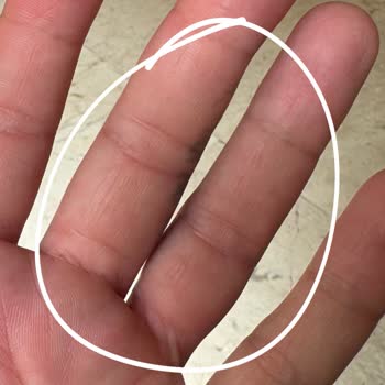 Fitamine Atakent Şubesinde EMS Seansı Sonrası Alerjik Reaksiyon Ve İade Sorunları