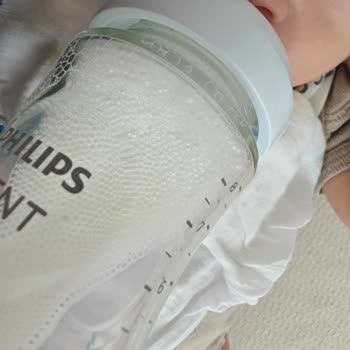 Philips Avent Biberon Başlığında Sürekli Köpük Sorunu Ve Değişim Talebi