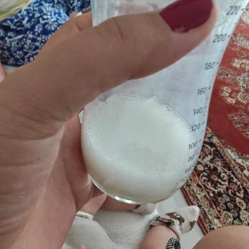 Philips Avent Biberon Başlığında Sürekli Köpük Sorunu Ve Değişim Talebi