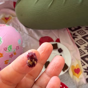 Lifalif Kırmızı Meyveli Barında Kıl Benzeri Yabancı Madde Ve Hijyen Sorunu