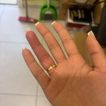 Alyansın Ölçü Hatası Nedeniyle Sağlık Sorunu Ve Mağaza Tarafından Ek Ücret Talebi