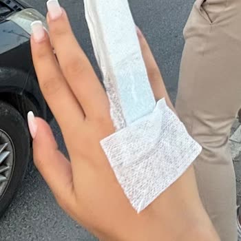 Alyansın Ölçü Hatası Nedeniyle Sağlık Sorunu Ve Mağaza Tarafından Ek Ücret Talebi