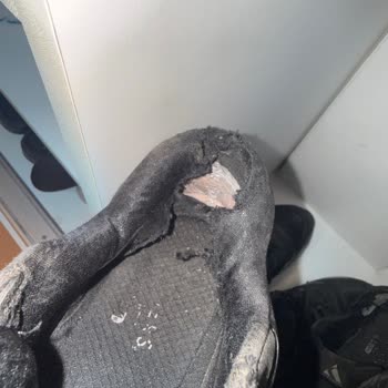 Skechers Ayakkabılarında Tekrarlayan Kalite Sorunları Ve Çözüm Eksikliği
