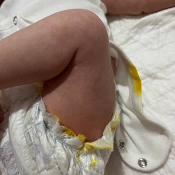 Prima Premium Care Bezinde Yanlardan Kaka Taşması Ve Sızıntı Sorunu