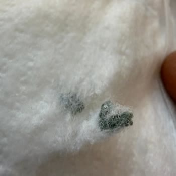 Molfix Bebek Bezinde Yabancı Madde Ve Hijyen Sorunu