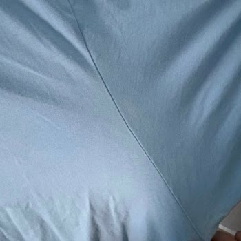 Lacoste Tişörtün Hızlı Renk Bozulması Ve Kalite Şikayeti
