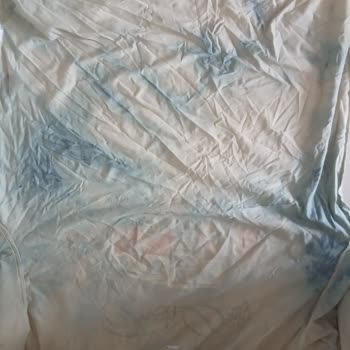 Yıkama Talimatına Uymama Sonrası Haki Tişörtün Deforme Olması Ve İade Reddi