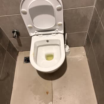 Aydın Şehir Hastanesi Acil Erkek Tuvaletinde Kirli Koşullar Ve Sağlık Riski