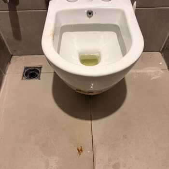 Aydın Şehir Hastanesi Acil Erkek Tuvaletinde Kirli Koşullar Ve Sağlık Riski