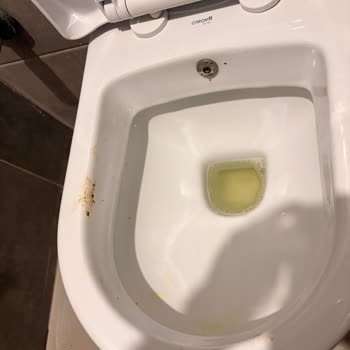 Aydın Şehir Hastanesi Acil Erkek Tuvaletinde Kirli Koşullar Ve Sağlık Riski