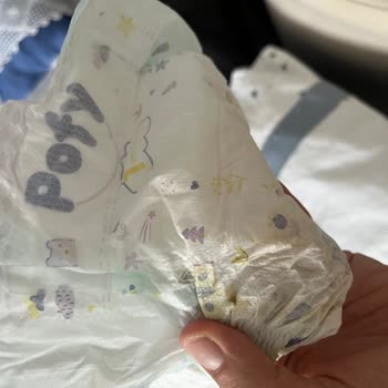 Ebebek Pofy Bebek Bezi Paketi İçinde Yırtık Bez Ve Ücret İadesi Talebi