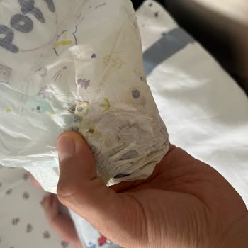 Ebebek Pofy Bebek Bezi Paketi İçinde Yırtık Bez Ve Ücret İadesi Talebi