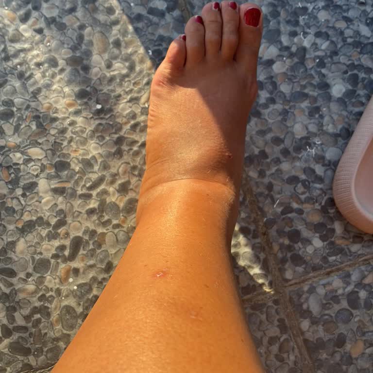 Varan Turizm Otobüs Arızası Nedeniyle Gecikme Ve Bacak Şişliği