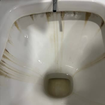 Kuşadası Sentinus Hotelde Hijyen Sorunları Ve Sağlık Mağduriyeti