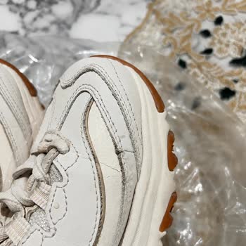 Skechers Ayakkabısının Kısa Sürede Yıpranması Ve İade Talebi