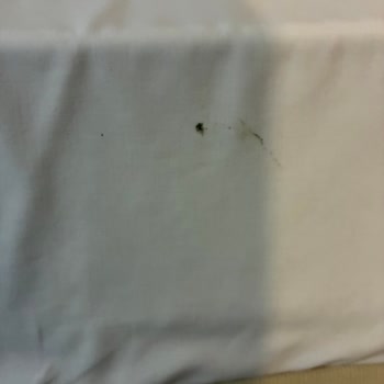 Acil Sağlık Durumunda Rehberin Yardım Etmemesi Ve Otel Kalitesizliği