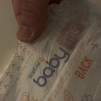 Bebek Bezinde Sert Plastik Parça Ve Mağazadan Cevap Yok