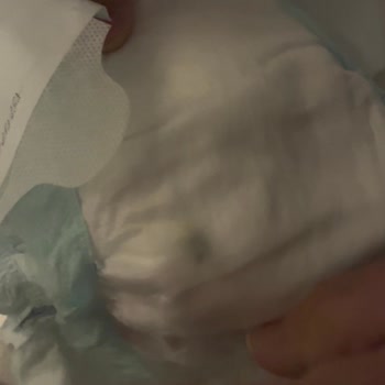 Bebek Bezinde Sert Plastik Parça Ve Mağazadan Cevap Yok