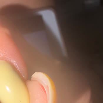 Yanıltıcı Kampanya Ücreti Ve Hijyen Sorunları Nedeniyle Mağdur Oldum