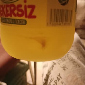 Uludağ Şekersiz Limonata Şişelerinde Yabancı Madde Ve Sağlık Endişeleri