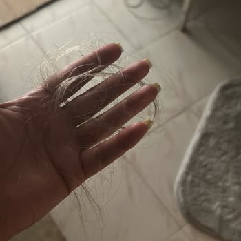 Saç Kaynağı Hizmetinde Yaşanan Sorunlar ve İade Talebi