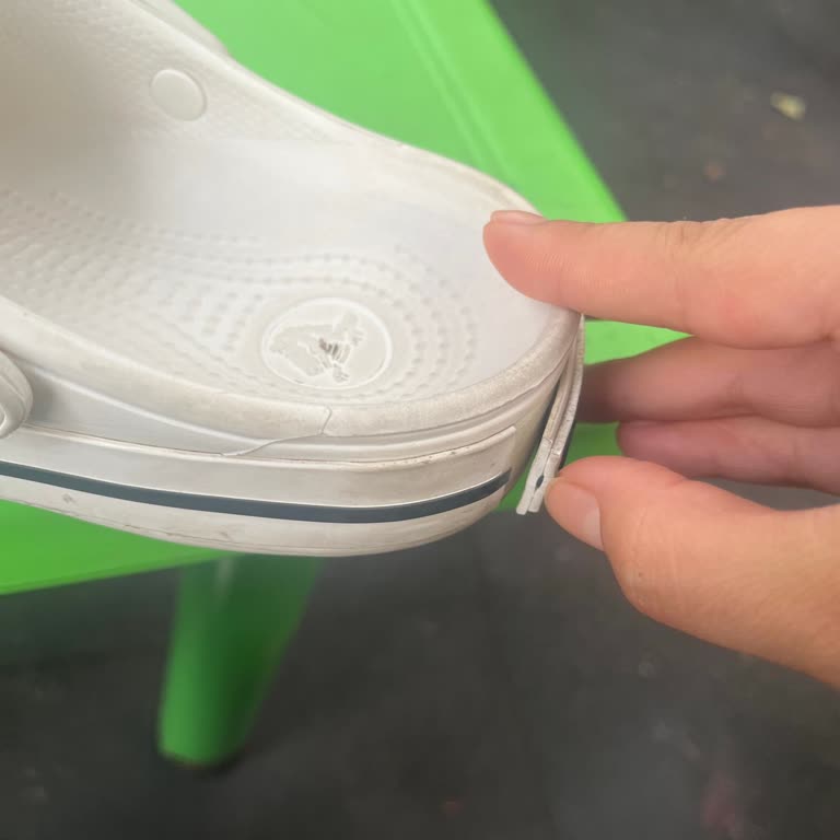 Crocs Tarzı Terlikte Etiket Sorunu Ve Müşteri Hizmetinden Yanıt Alamama