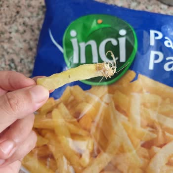 Ekzimer Parmak Patates Ürününde Yabancı Saçaklı Maddeler Ve Hijyen Endişesi