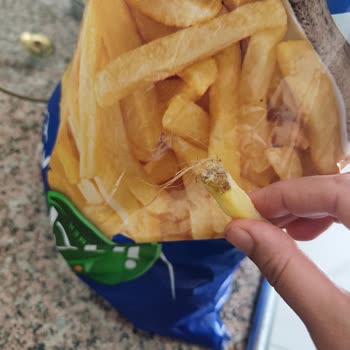 Ekzimer Parmak Patates Ürününde Yabancı Saçaklı Maddeler Ve Hijyen Endişesi