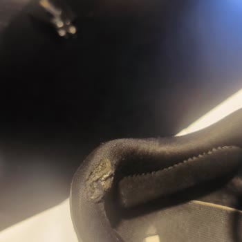 Adidas Spor Ayakkabısının Kısa Sürede Deforme Olması Ve Değişim Reddi