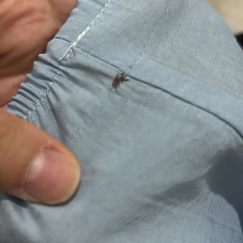 Ayıplı Elbise İçin İade Talebi Ve Müşteri Hizmetlerinden Yanıt Yok