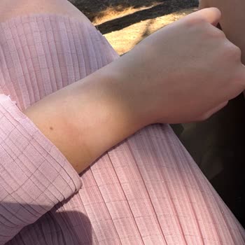Aşırı Isınan Apple Watch Yanık Yaptı, Destek Tekrar Tekrar Yüksek Bedelli Değişim Teklifi Sunuyor