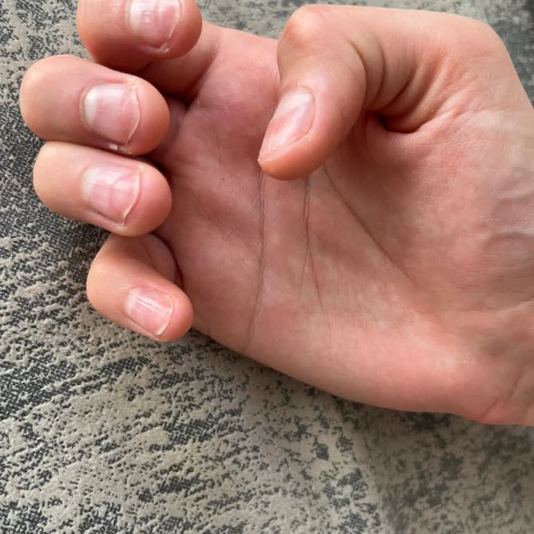 Lavinya Nail Beauty’de Tırnak İzleri Ve Kirpik Düşüşü: İade Bekliyorum