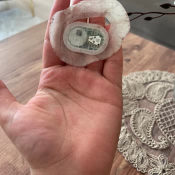 Sibionics GS1 Cihazı Sinyal Kaybı Ve Sensör Yapışkan Sorunu