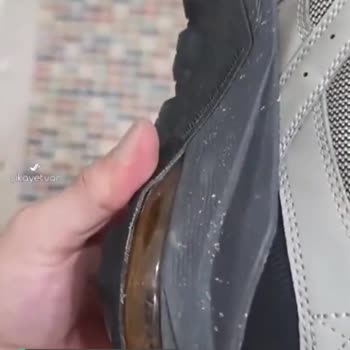 Skechers Ayakkabımda Açılma Meydana Geldi
