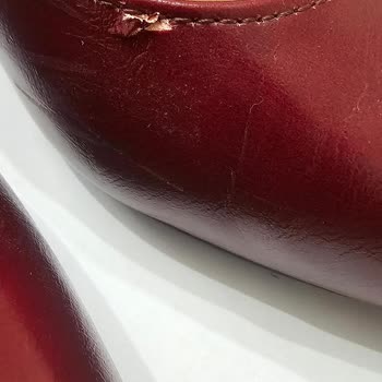 Kısa Sürede Deri Soyulması Ve Üretim Hatası Görmezden Gelinen Ayakkabı