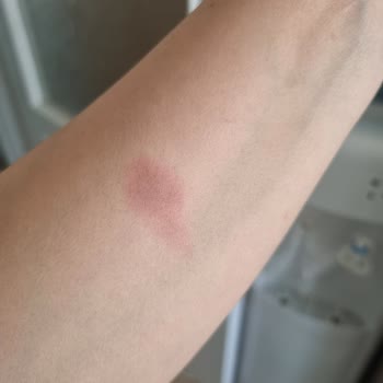 Yanıcı Ve Sağlık Tehlikesi Yaratan Yörsan Tereyağı