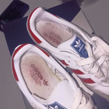 Adidas Ayakkabısında 20 Günlük Kullanımda Deformasyon Ve Renk Atması, İade Ve Değişim Talebi