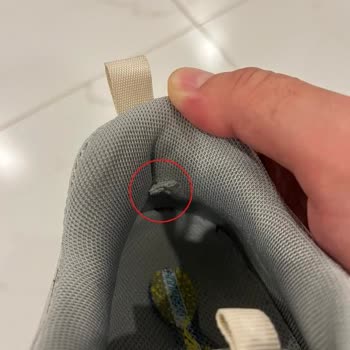 13 Gün Sonra Topuk Astarı Hasarı Ve Kullanıcı Hatası Kararı Nedeniyle Lescon Kullanımı Bırakıldı