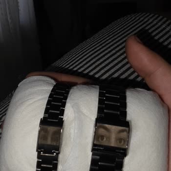 Yanlış Renk Ve Kötü Fotoğraf Baskısı, Bileklik Eksikliği Ve İletişimsizlik Nedeniyle Değişim Talebi