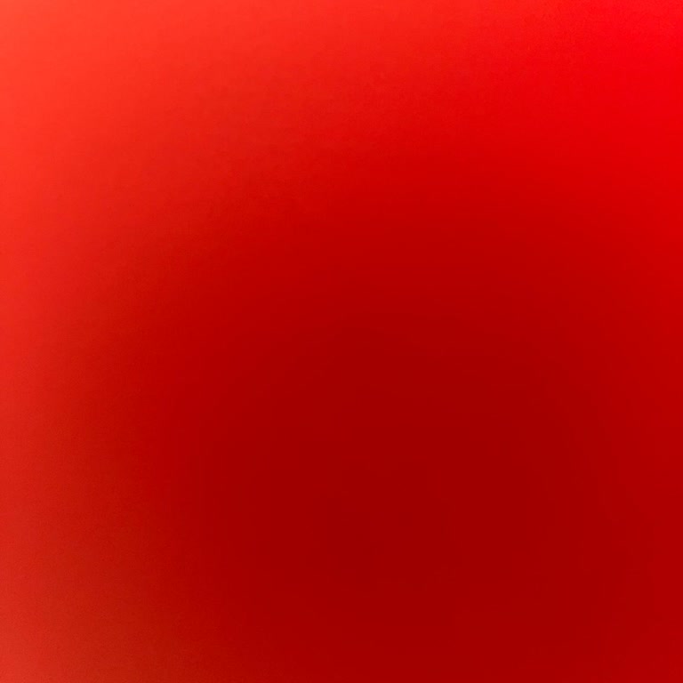 Kapanan Lazer Epilasyon Paketi, Kalan Seanslar İçin İade Talebi