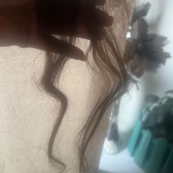 Şampuan Kullanımı Sonrası Çocuğumda Şiddetli Saç Dökülmesi Ve Psikolojik Çöküntü
