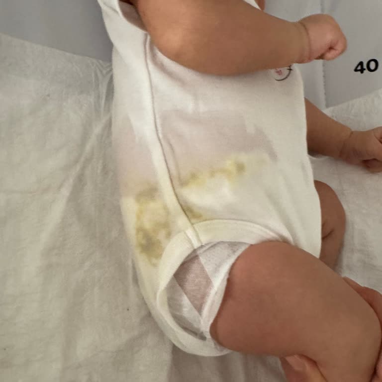 Molfix Bebek Bezlerinde Sürekli Sızdırma Sorunu